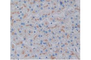 Immunohistochemistry (IHC) image for anti-Heme Oxygenase (Decycling) 1 (HMOX1) (AA 61-172) antibody (ABIN7425956)
