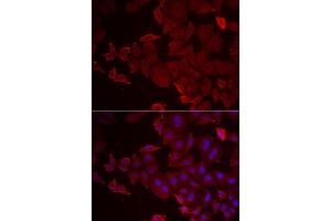 Immunofluorescence analysis of U2OS cell using MARCKSL1 antibody. (MARCKSL1 antibody)