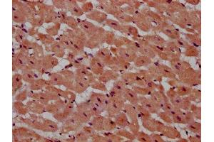 IHC image of ABIN7164923 diluted at 1:600 and staining in paraffin-embedded human heart tissue performed on a Leica BondTM system. (PSME4 antibody  (AA 105-198))