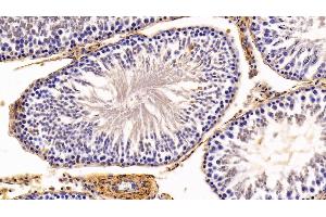 Immunohistochemistry (IHC) image for anti-Caveolin 1, Caveolae Protein, 22kDa (CAV1) (AA 2-105) antibody (ABIN7431326)