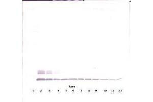 Image no. 3 for anti-Chemokine (C-C Motif) Ligand 8 (CCL8) antibody (ABIN465585) (CCL8 antibody)