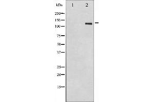 Western blot analysis of Integrin beta3 expression in HepG2 whole cell lysates,The lane on the left is treated with the antigen-specific peptide. (Integrin beta 3 antibody  (C-Term))