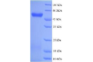 SDS-PAGE (SDS) image for Hyaluronidase-2 (HYAL2) (AA 21-448) protein (His tag) (ABIN5714322) (HYAL2 Protein (AA 21-448) (His tag))