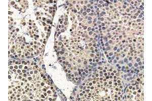 FOXM1 Mouse Monoclonal Antibody at 1/100 staining mouse testis tissue by IHC-P.