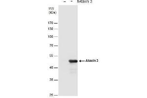 WB Image Ataxin 3 antibody detects Ataxin 3 protein by western blot analysis.