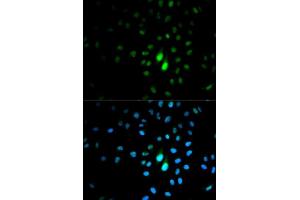 Immunofluorescence analysis of MCF-7 cells using PIN1 antibody.