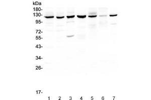 Western blot testing of PARP antibody and Lane 1:  COLO320 (PARP1 antibody  (AA 670-858))