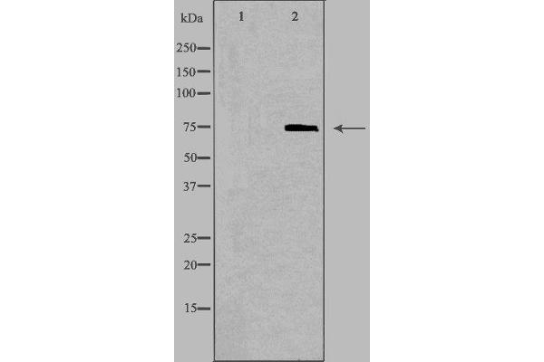 ABCD1 antibody  (Internal Region)