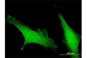 Immunofluorescence of purified MaxPab antibody to EFCAB4B on HeLa cell. (EFCAB4B antibody  (AA 1-395))