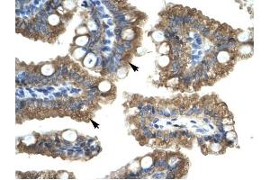 CHRNA1 antibody was used for immunohistochemistry at a concentration of 4-8 ug/ml to stain Epithelial cells of intestinal villus (arrows) in Human Intestine.