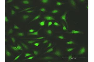 Immunofluorescence of purified MaxPab antibody to FANCC on HeLa cell.