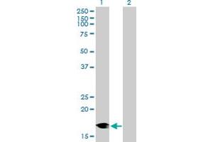DCTN3 antibody  (AA 1-176)