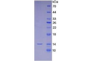 SDS-PAGE (SDS) image for Lipotropin, beta - protein (ABIN5979126) (Lipotropin, beta - Protein)