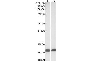 ABIN361198 (0. (Caveolin 3 antibody  (N-Term))