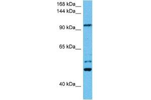 Host:  Mouse  Target Name:  KIF23  Sample Tissue:  Mouse Testis  Antibody Dilution:  1ug/ml (KIF23 antibody  (N-Term))