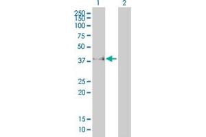 Western Blot analysis of FCGR2B expression in transfected 293T cell line by FCGR2B monoclonal antibody (M01A), clone 2E10. (FCGR2B antibody  (AA 45-154))