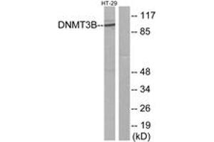 Western blot analysis of extracts from HT-29 cells, using DNMT3B Antibody. (DNMT3B antibody  (AA 1-50))