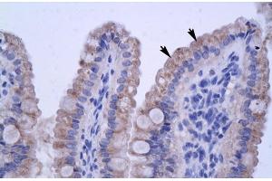 Human Intestine (ZNF358 antibody  (N-Term))