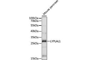 Western blot analysis of extracts of Mouse pancreas, using LYPL antibody (ABIN7268340) at 1:1000 dilution. (LYPLAL1 antibody  (AA 1-100))
