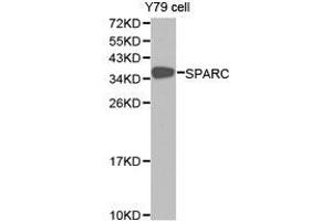 Western Blotting (WB) image for anti-Secreted Protein, Acidic, Cysteine-Rich (Osteonectin) (SPARC) antibody (ABIN1874918) (SPARC antibody)