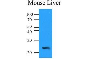 Mouse liver lysates (35 ug) were resolved by SDS-PAGE, transferred to PVDF membrane and probed with anti-human NQO2 (1:500). (NQO2 antibody  (AA 1-231))