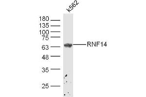 K562 lysates probed with ADAM2 Polyclonal Antibody, Unconjugated  at 1:300 dilution and 4˚C overnight incubation. (ADAM2 antibody  (AA 451-550))