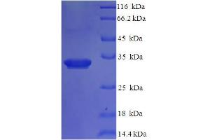 SDS-PAGE (SDS) image for Interleukin 1 delta (FIL1d) (AA 1-155), (full length) protein (His-SUMO Tag) (ABIN5711795)