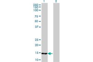 Western Blot analysis of UBE2B expression in transfected 293T cell line by UBE2B monoclonal antibody (M06), clone 4C3.