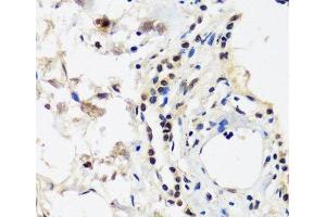 Immunohistochemistry of paraffin-embedded Human lung using CAND1 Polyclonal Antibody at dilution of 1:100 (40x lens). (CAND1 antibody)