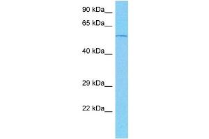 Host:  Mouse  Target Name:  TRIM31  Sample Tissue:  Mouse Heart  Antibody Dilution:  1ug/ml (TRIM31 antibody  (N-Term))