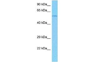 Host:  Mouse  Target Name:  TRIM31  Sample Tissue:  Mouse Heart  Antibody Dilution:  1ug/ml (TRIM31 antibody  (N-Term))