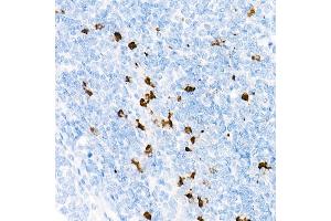 Immunohistochemistry of paraffin-embedded Human tonsil using Myeloperoxidase (MPO) antibody (ABIN7268726) at dilution of 1:1000 (40x lens).