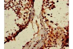 Immunohistochemistry of paraffin-embedded human testis tissue using ABIN7164194 at dilution of 1:100 (WTAP antibody  (AA 1-151))
