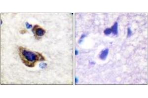 Immunohistochemistry analysis of paraffin-embedded human brain tissue, using GFAP (Ab-38) Antibody. (GFAP antibody  (AA 11-60))