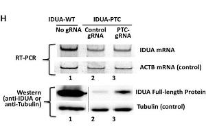 Western Blotting Analysis Source: PMID36764303 (IDUA antibody)