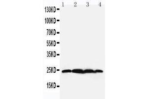 Anti-BAG2 antibody, Western blotting Lane 1: Rat Testis Tissue Lysate Lane 2: HELA Cell Lysate Lane 3: A549 Cell Lysate Lane 4: A431 Cell Lysate (BAG2 antibody  (N-Term))