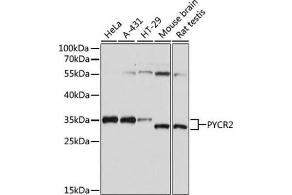 PYCR2 antibody  (AA 271-320)