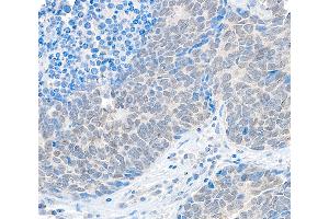 Immunohistochemistry (IHC) image for anti-Ubiquitin Specific Peptidase 37 (USP37) (C-Term) antibody (ABIN7453891) (USP37 antibody  (C-Term))