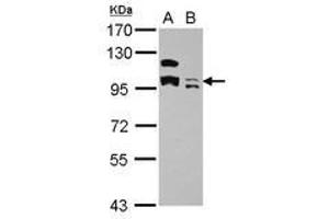 Image no. 3 for anti-Potassium Channel Tetramerisation Domain Containing 19 (KCTD19) (AA 1-162) antibody (ABIN1501897) (KCTD19 antibody  (AA 1-162))