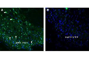 Expression of Tetraspanin 2 (TSPAN2) in rat spinal cord.