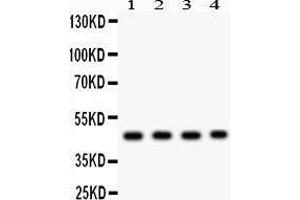 Anti- MBD2 antibody, Western blotting All lanes: Anti MBD2  at 0. (MBD2 antibody  (AA 159-411))