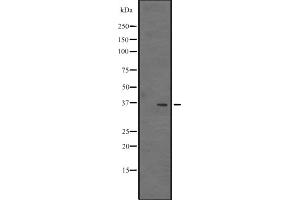 Western blot analysis of VSIG2 expression in 293 cell lysate ;,The lane on the left is treated with the antigen-specific peptide. (VSIG2 antibody  (Internal Region))