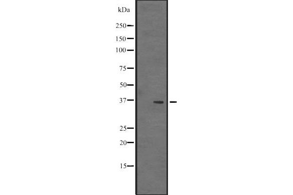 VSIG2 antibody  (Internal Region)