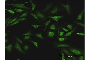Immunofluorescence (IF) image for anti-V-Raf Murine Sarcoma 3611 Viral Oncogene Homolog (ARAF) (AA 1-606) antibody (ABIN513450)
