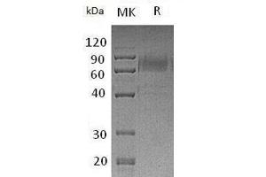 Western Blotting (WB) image for TYRO3 Protein Tyrosine Kinase (TYRO3) protein (mFc Tag) (ABIN7320680) (TYRO3 Protein (mFc Tag))