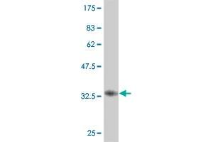 Western Blot detection against Immunogen (36. (UBTF antibody  (AA 551-650))