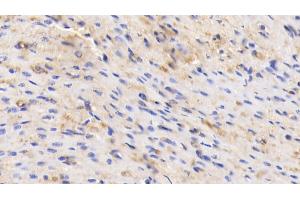 Detection of ALB in Human Cardiac Muscle Tissue using Polyclonal Antibody to Albumin (ALB) (Albumin antibody)