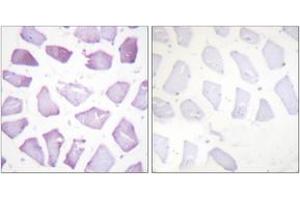 Immunohistochemistry analysis of paraffin-embedded human skeletal muscle, using PEA-15 (Phospho-Ser116) Antibody. (PEA15 antibody  (pSer116))