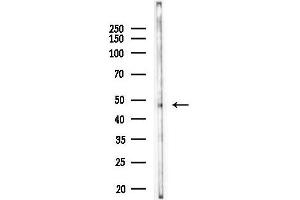 anti-Cysteine Conjugate-beta Lyase 2 (CCBL2) antibody