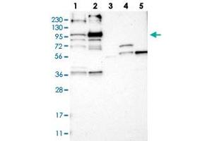 Western blot analysis of Lane 1: RT-4, Lane 2: U-251 MG, Lane 3: Human Plasma, Lane 4: Liver, Lane 5: Tonsil with LRCH2 polyclonal antibody  at 1:250-1:500 dilution.